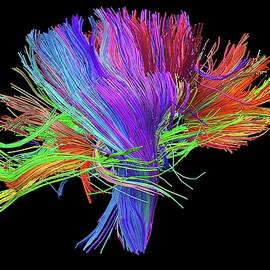 White Matter Fibres Of The Human Brain by Alfred Pasieka / Science Photo Library