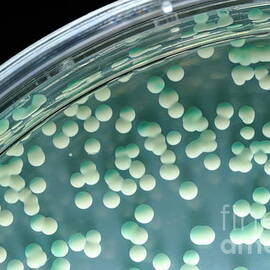 Candida albicans colony in petri dish by Sami Sarkis Photography