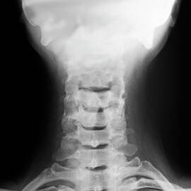 Cervical vertebra and head X-ray by Sami Sarkis Photography