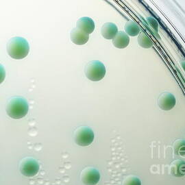 Candida albicans colony in petri dish by Sami Sarkis Photography