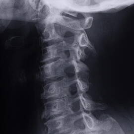 Cervical vertebra and head X-ray by Sami Sarkis Photography