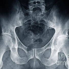 Hip X-ray by Sami Sarkis Photography