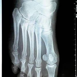 X-ray image of a mature woman foot by Sami Sarkis Photography