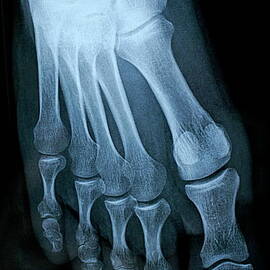 X-ray image of mature man's feet by Sami Sarkis Photography