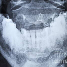 X-ray of healthy mature man's jawbone by Sami Sarkis Photography