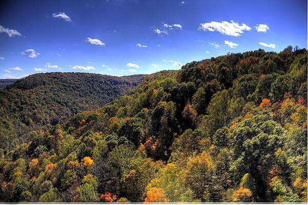 Tree Wall Art featuring the photograph Trees Over Rolling Hills by Jonny D