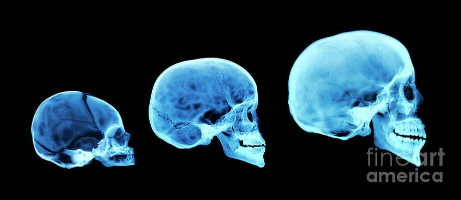 Skull Wall Art for Sale by Science Photo Library