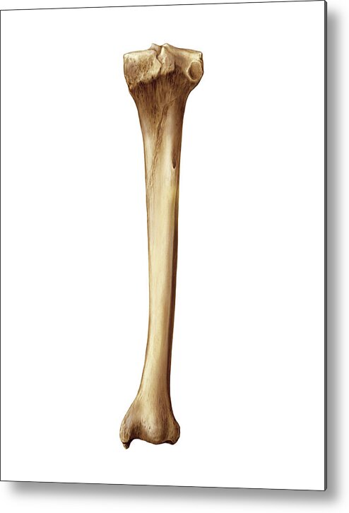 Tibia Pieces Tibia #5 Metal Print by Asklepios Medical Atlas / Science Photo Library ...