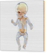 Baby's Skeletal System #29 by Pixologicstudio / Science Photo Library